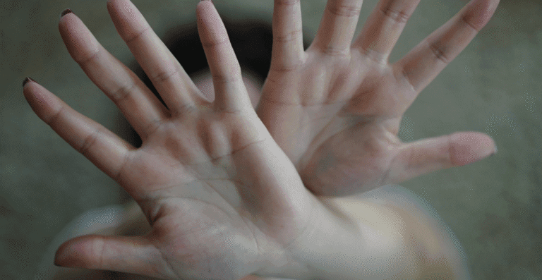 Uma mulher com as duas mãos abertas a frente do rosto, com se estivesse se escondendo de algo.